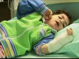 Cairo hospitals treat Gaza's war-scarred children -25 Jan 09