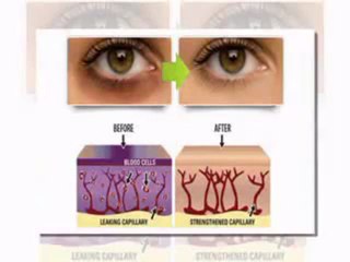 Vivexin Review - Check Out This Essential Vivexin Review