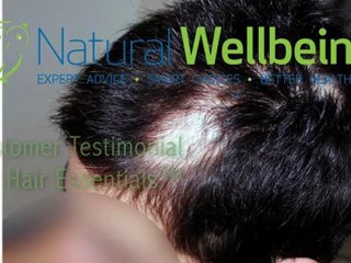 Hair Essentials for Female Hair Loss