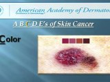 ABCDEs of Skin Cancer Detection | All-County Dermatology