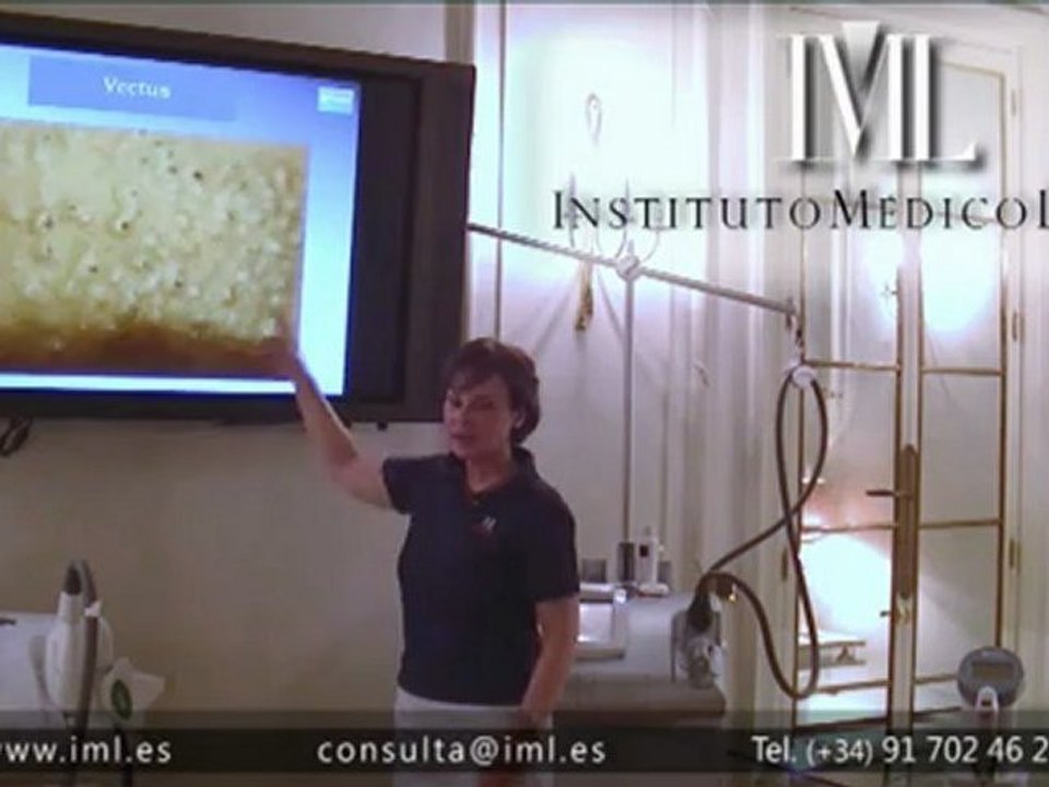 Vectus: el láser de Diodo más eficaz para depilación