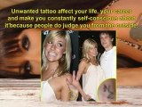 Get Rid of Tattoo Naturally