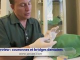 Soins dentaire à Budapest : couronnes et bridges dentaires