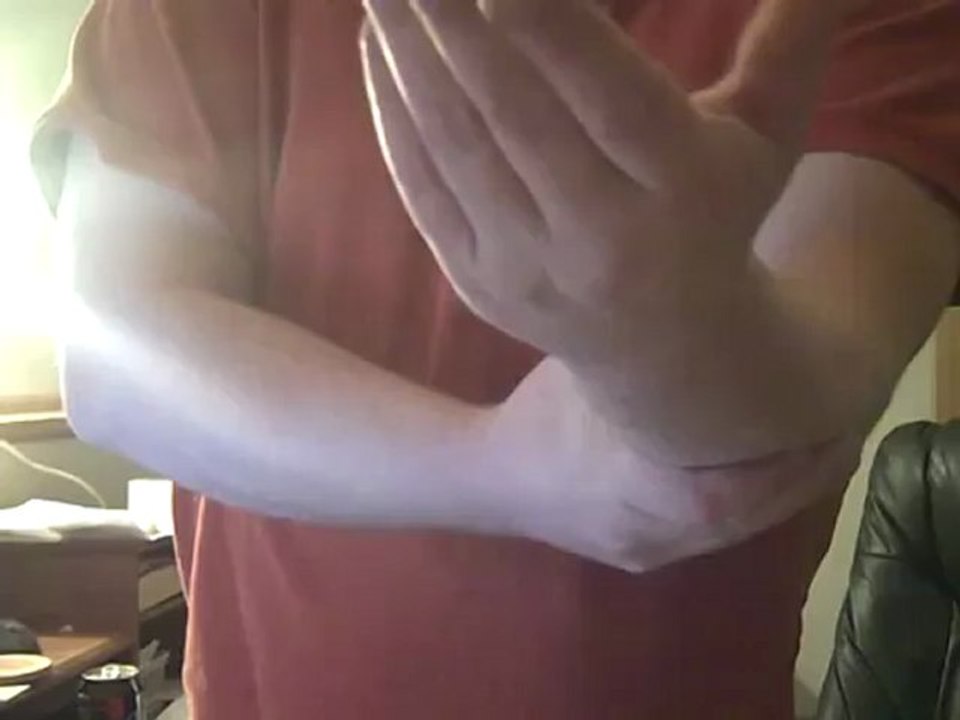 RE: Palm Pain
