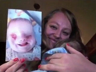 Insolite : Bébé né sans yeux