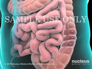 Colon problems treatment - Colon Resection Surgery