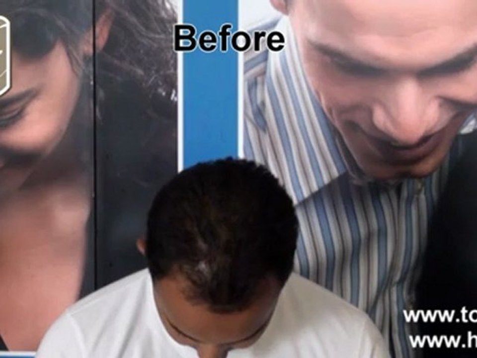 Toppik Hair Building Fibers, No. 1 Hair Loss Solution!