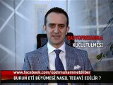 Burun eti büyümesi nasıl tedavi edilir?-  Op.Dr.Muhammet DİLBER