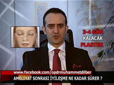 Burun ameliyatı sonrası iyileşme ne kadar sürer? - Op.Dr.Muhammet DİLBER