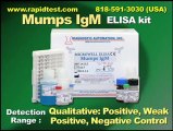 Mumps IgM ELISA kit