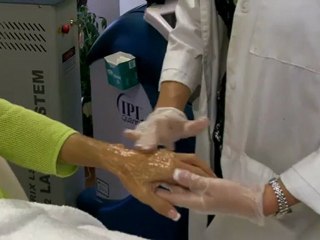 Advanced Clinics of Huntsville Hand Rejuvenation