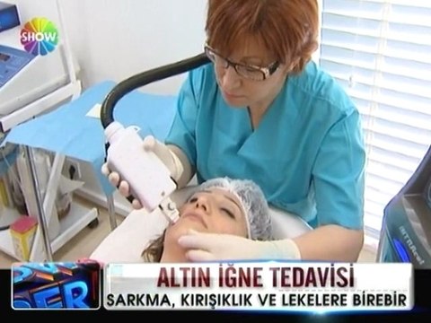 Altın iğne tedavisi - 16 mayıs 2012