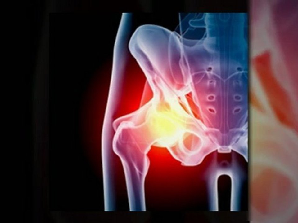 Are You filing for a Depuy Hip Recall Lawsuit?