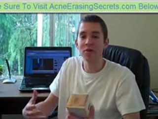 Does Tea Cause Acne And Pimples?