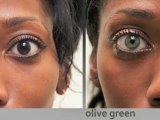 Change eye color permanently / brightocular/ eye color change surgery / eye color change procedure