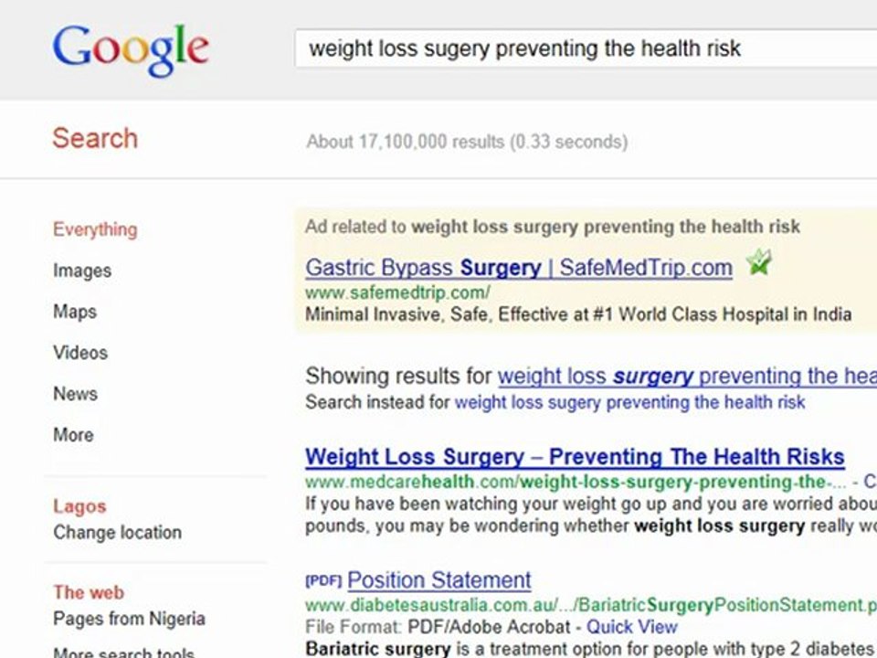 weight loss surgery prevention--Health risks