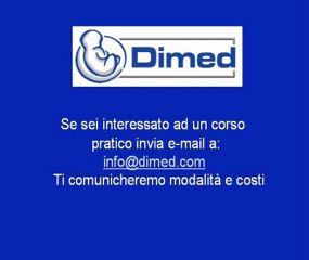 Metodologia per lo studio delle scansioni assi lunghi partendo dalla 4 camere