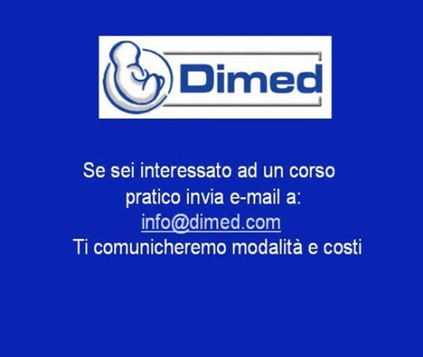 Cuore sinistro ipoplasico