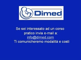 Ventricolo destro a doppia uscita