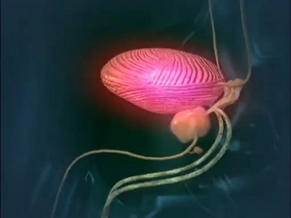 Blasenentzündung bei Männern