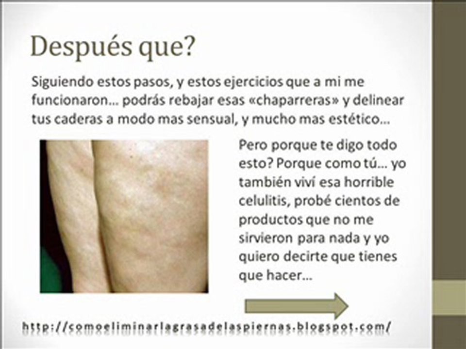 Ejercicios Para Eliminar La Celulitis De Los Glúteos