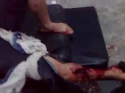 Syria فري برس ريف دمشق عربين هااام للاعلام اصابات جراء القصف 22 5 2012 ج2 Damascus