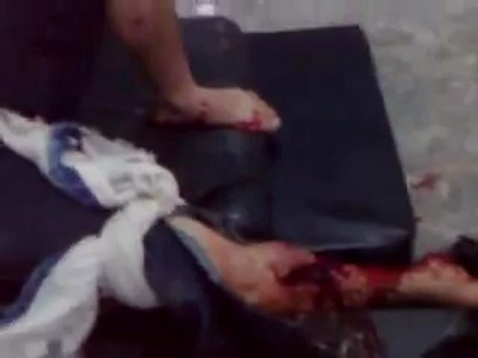 Syria فري برس  ريف دمشق عربين  هااام للاعلام اصابات جراء القصف    22 5 2012  ج2 Damascus