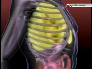 TG 19.05.12 Turbercolosi: è psicosi, dopo Triggiano contagiata maestra a Biseglie