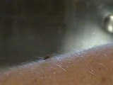 Feeding a Bed Bug | How to Feed a Bed Bug | Pic of Bed Bugs