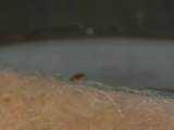 Live Bed Bug Picture | Bed Bug Images | Picture of Live Bedbugs