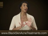 Black Skin Dermatologists - RX for Brown Skin