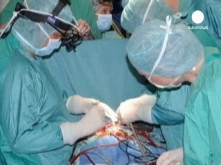 Implantan con éxito el corazón articial más pequeño...