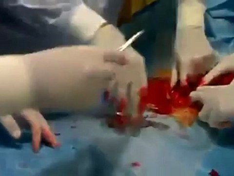 Syria فري برس درعا بصرى الشام عملية جراحية في المشفى الميداني +18 24 5 2012 ج1 Daraa