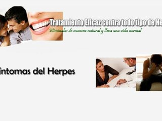 Sintomas del Herpes