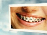 310-246-4646 'Dentist Beverly Hills' 90211 oral surgery, periodontics, dentures, Dr. Arman Dayan
