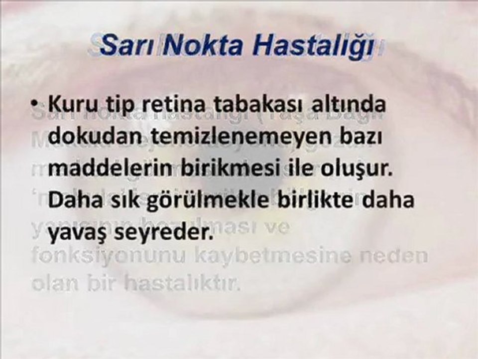 Sarı Nokta,Sarı Nokta Hastalığı,Sarı Nokta Göz Hastalığı,Sarı Nokta Hastalığı Belirtileri