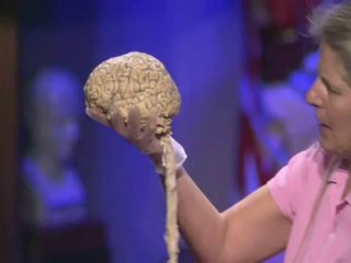 Supplements for brain -Jill Bolte Taylor-Part1