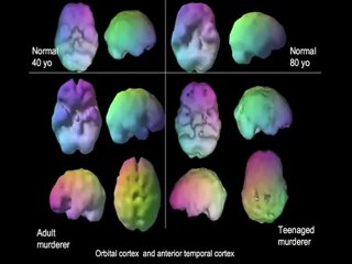 Vitamins for memory-Jim Fallon-Part1