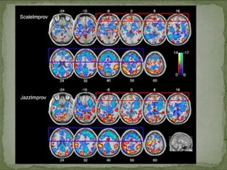 Brain Health Supplements-Charles Limb-Part2