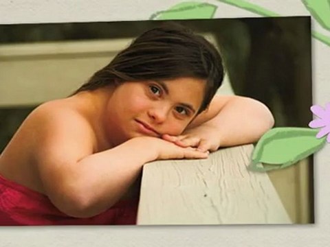 Down Syndrome Facts and Its Definition