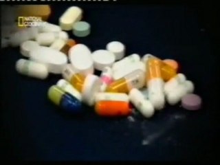 Doug: Adiccion a los analgesicos (Oxicodona)