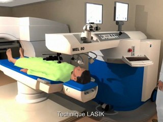 chirurgie réfractive femtolasik