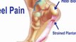 Heel Pain Treatment - Kansas City, MO and Overland Park, KS - Podiatrist