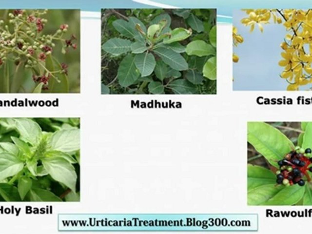 Solar Urticaria Treatment – Acute Urticaria Treatment – Papular Urticaria Treatment