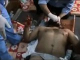 Syria فري برس  حمص القصير عشرات الجرحى في المشفى الميداني 30 5 2012 Homs