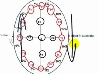 EEG,Understanding EEG - Part 4, 10 20 electrode placement system, What is electroencephalography (EEG)?