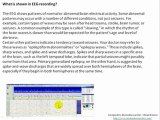 Understanding EEG- Part 6: More details, What is electroencephalography (EEG)?