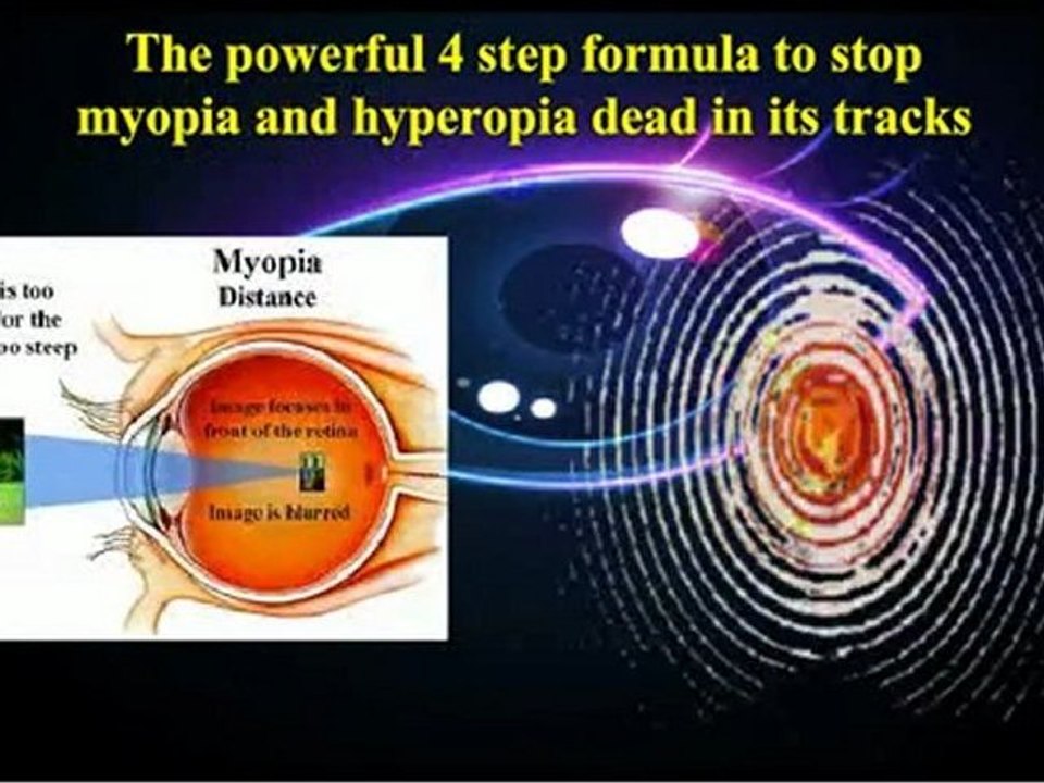 Step-By Step Program To Restore Near Perfect Vision