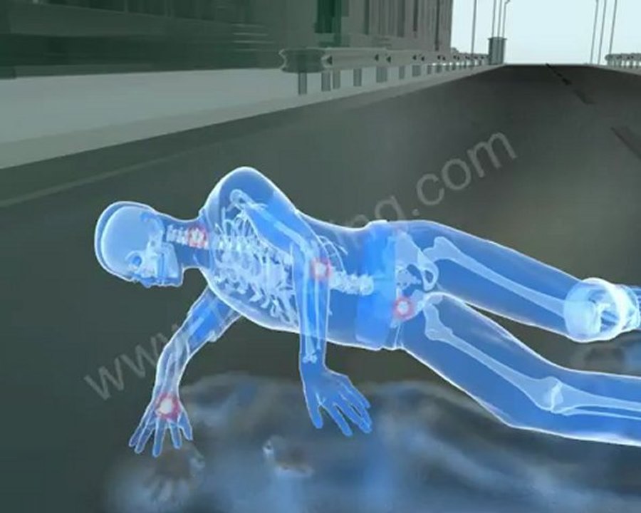 Accident Animation: Slip and Fall - video Dailymotion