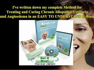 Urticaria & Angioedema Treatment